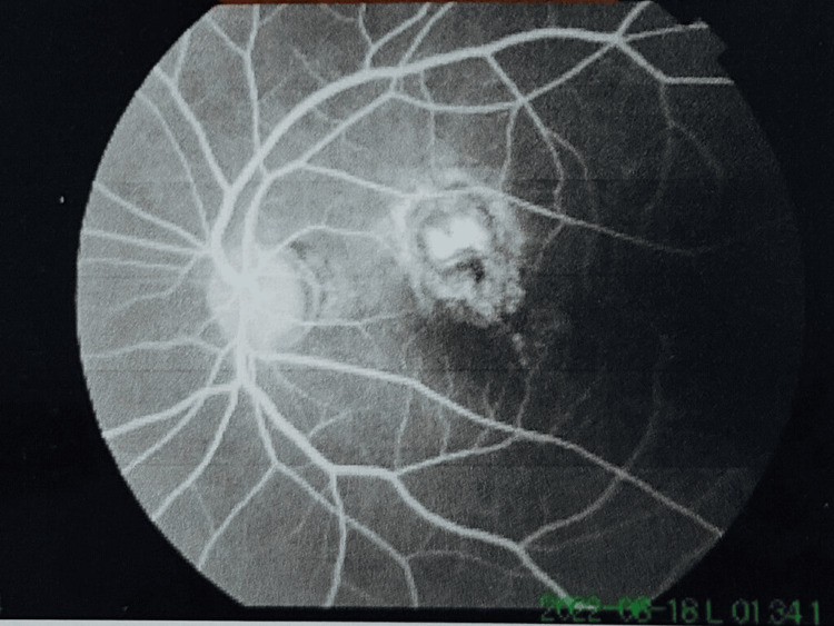 Figure 4