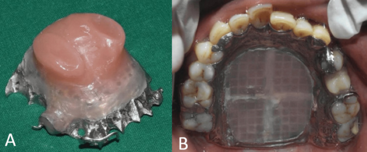Figure 11