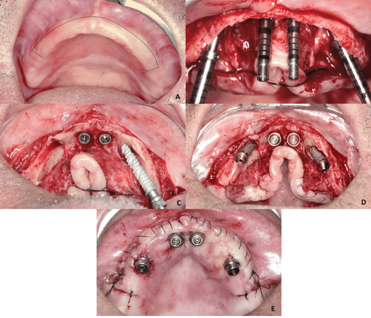 Figure 2