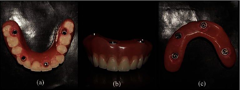 Figure 11