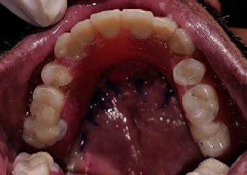 Figure 12