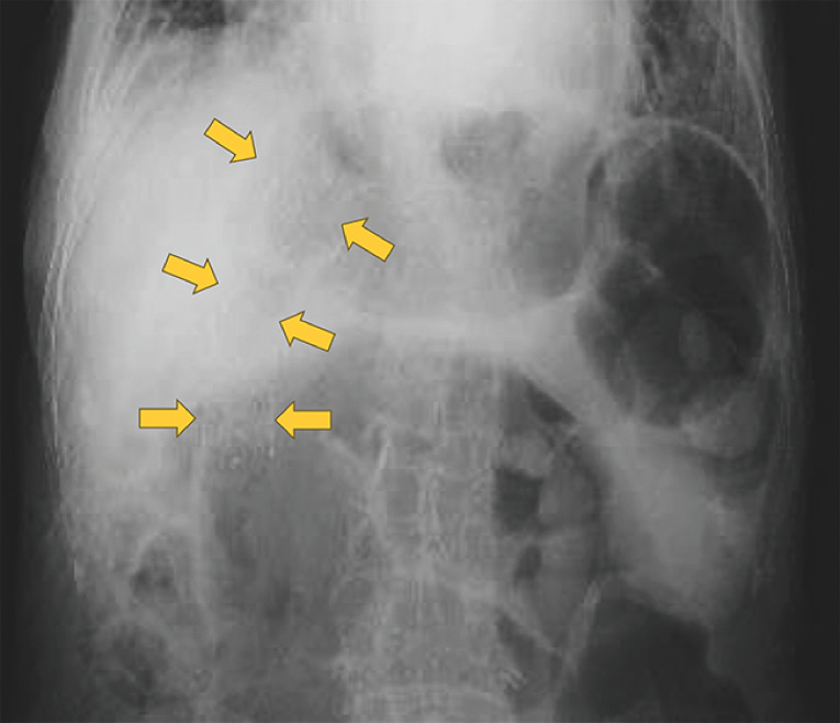 Fig. 4