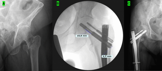 Figure 1