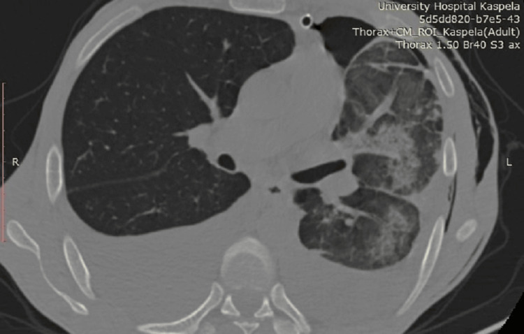 Figure 5
