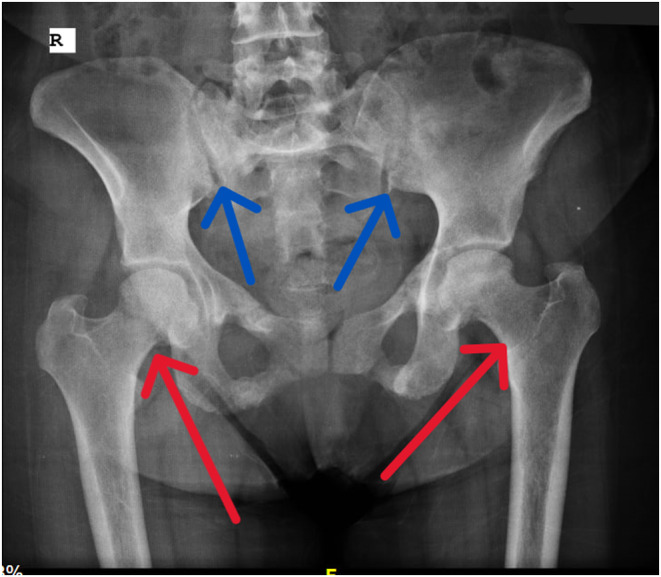 FIGURE 2