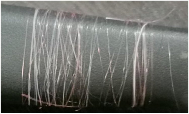 Figure 14