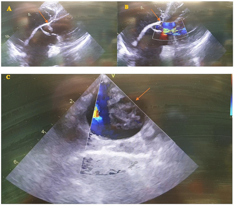 Figure 2