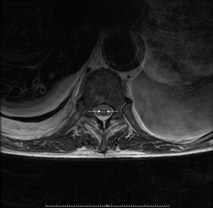 Figura Nº 2