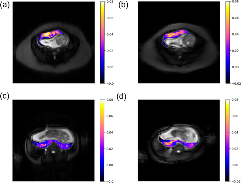Fig 4