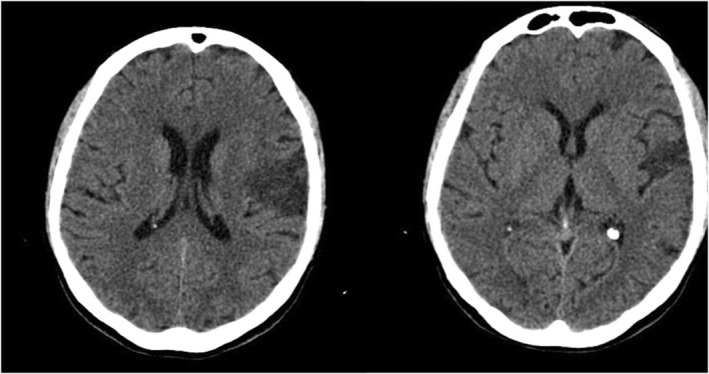 FIGURE 1