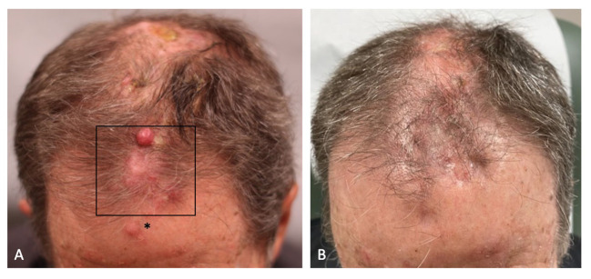 Figure 1