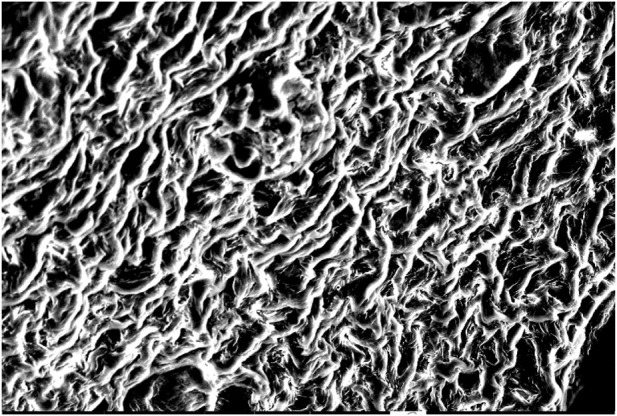 FIGURE 11
