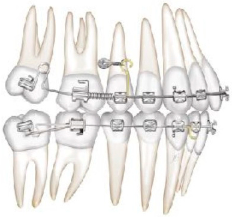 Figure 5
