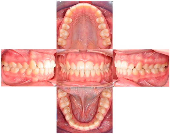 Figure 11