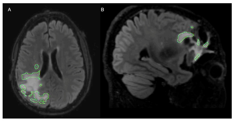 Figure 7