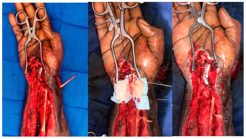 Figure 11