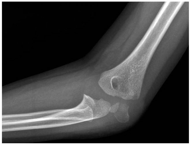 Figure 11