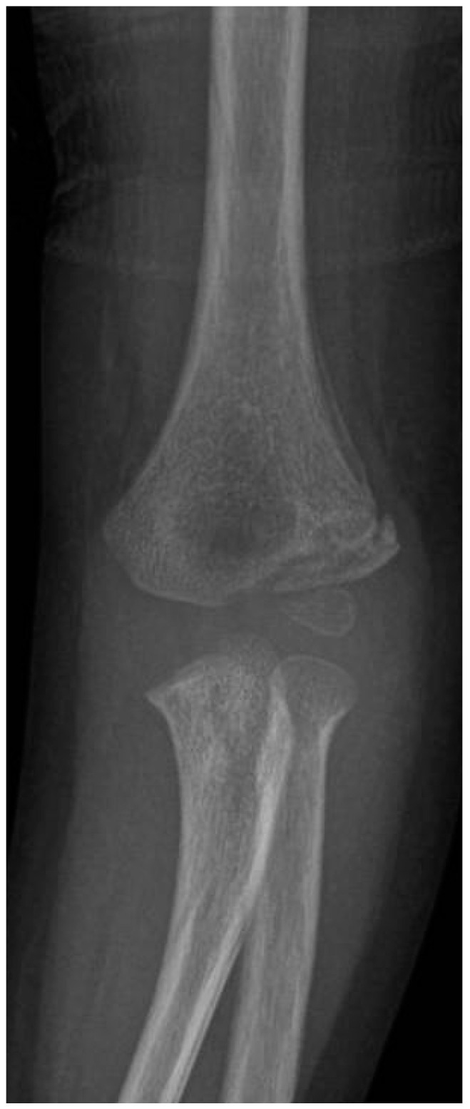 Figure 12