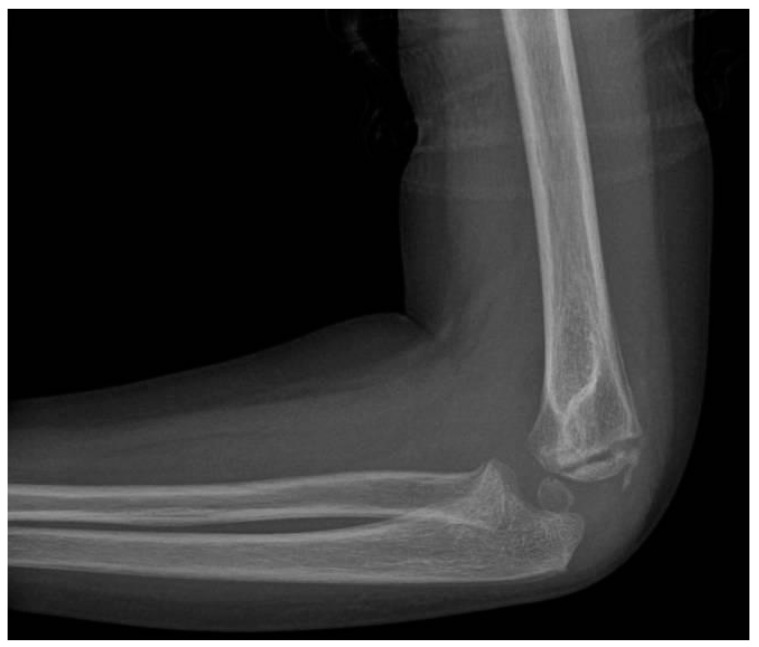 Figure 13