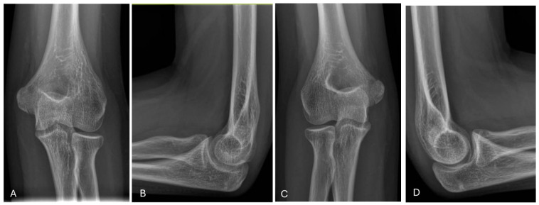 Figure 14