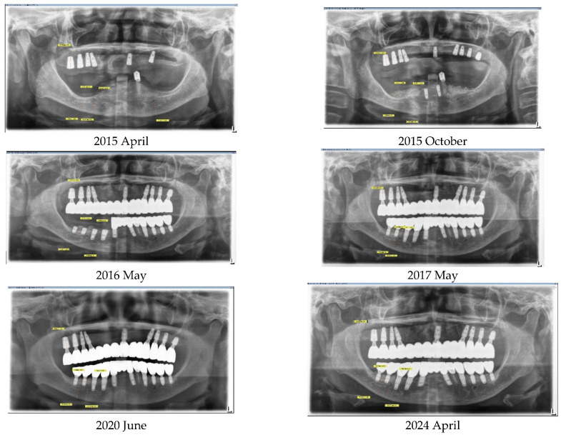 Figure 11