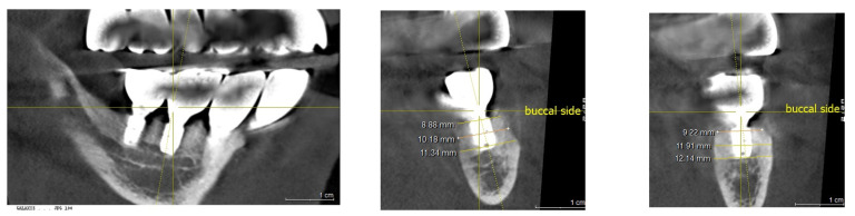 Figure 12