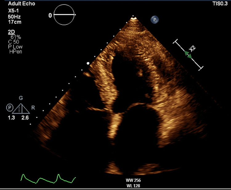 Figure 5