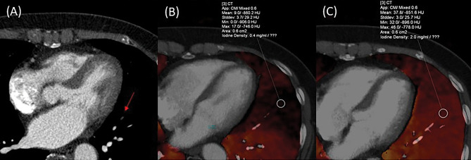 Figure 4