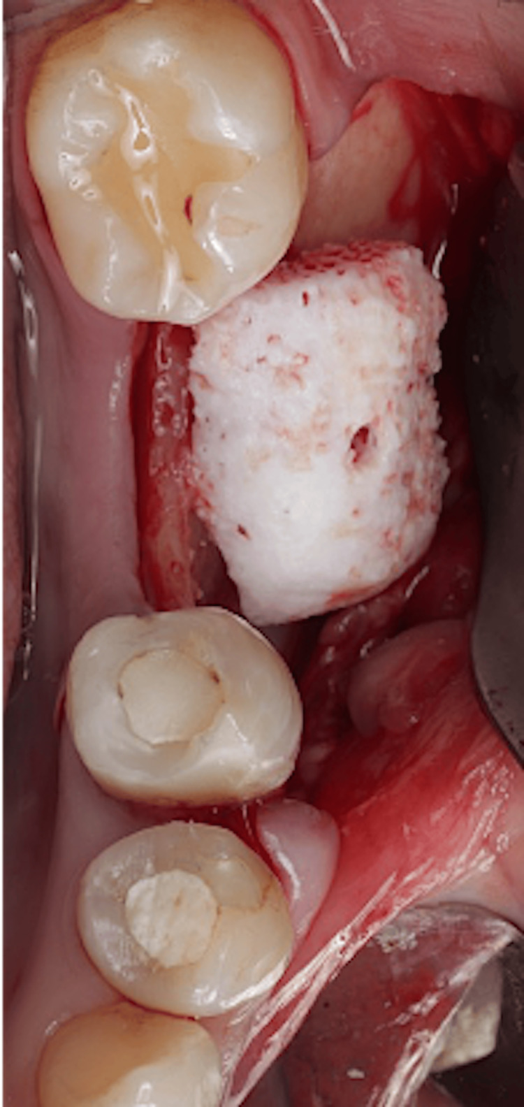 Figure 9