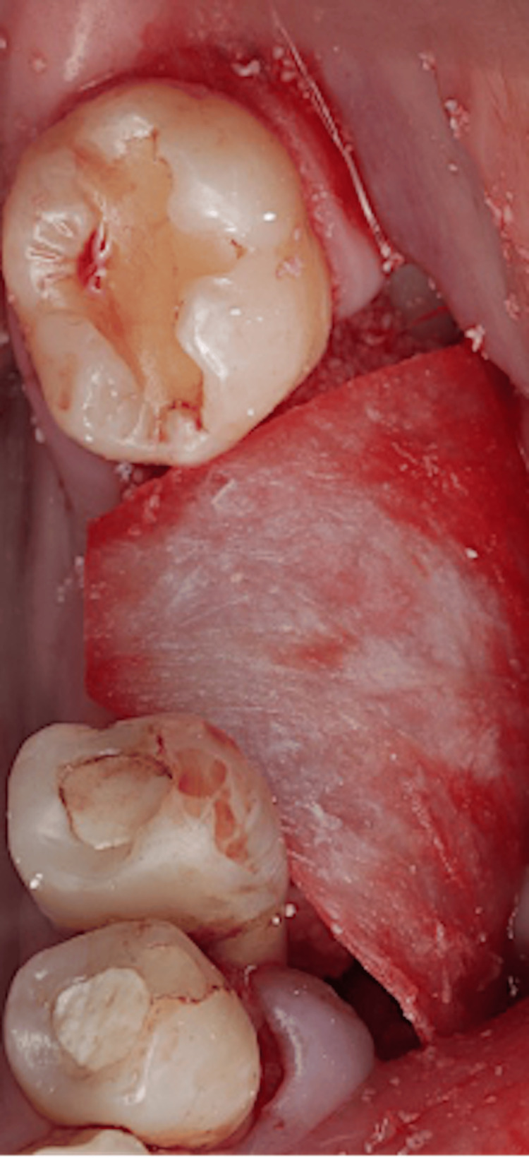 Figure 10
