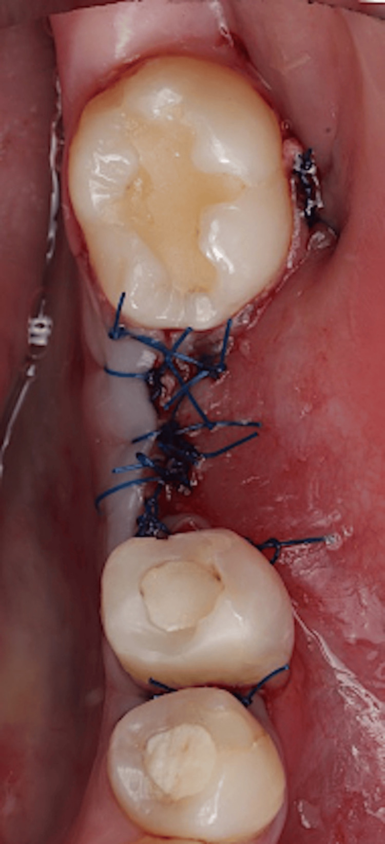 Figure 11