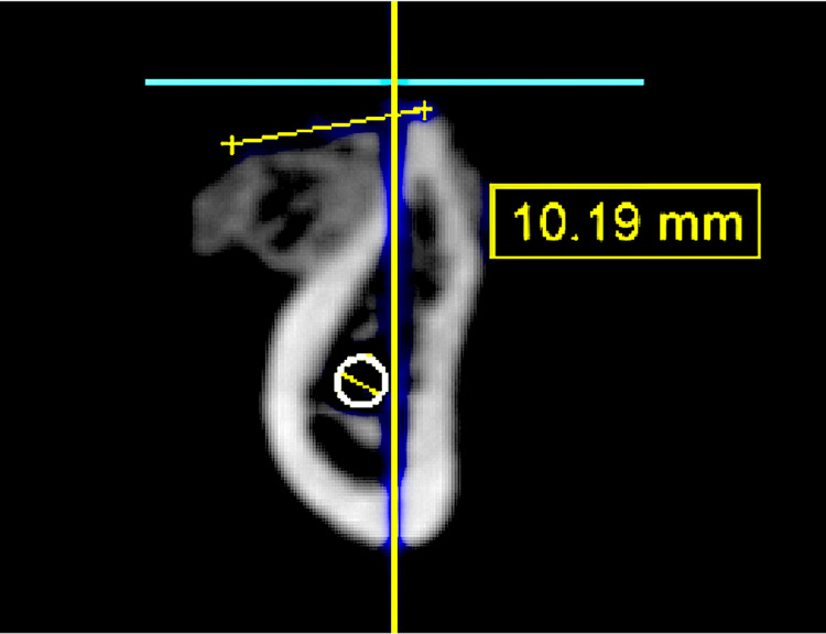 Figure 12