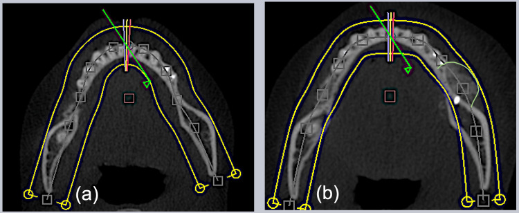 Figure 13