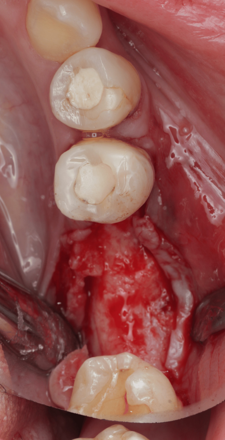 Figure 14