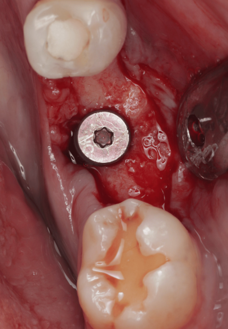 Figure 15