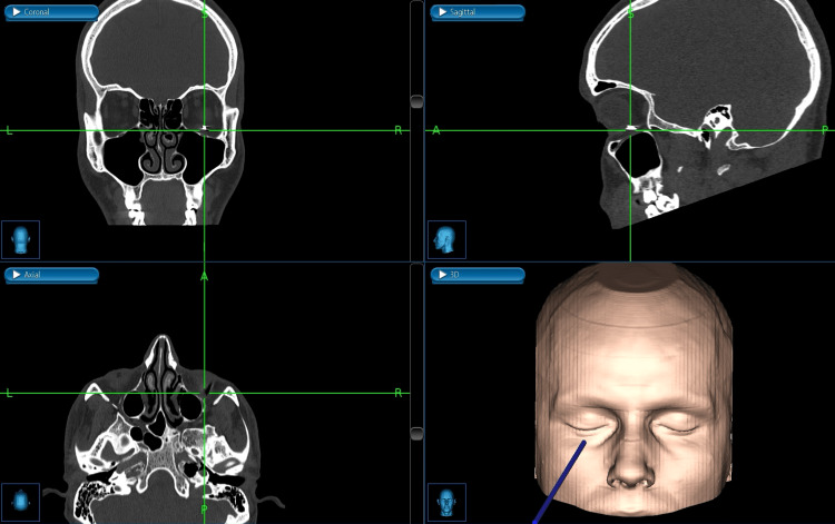 Figure 5