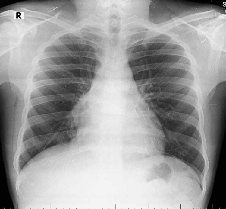 Figure 9