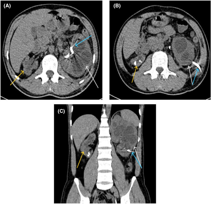 FIGURE 1