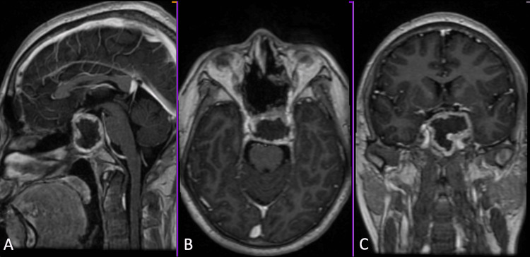 Figure 6