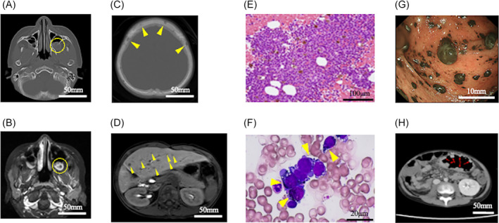 FIGURE 1
