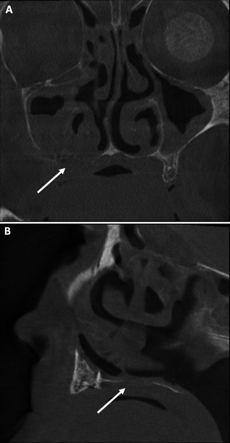 Figure 10