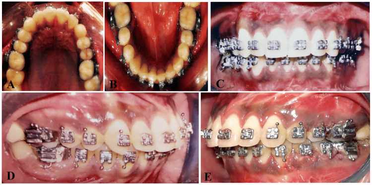 Figure 12