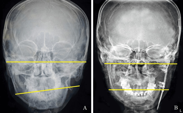 Figure 14