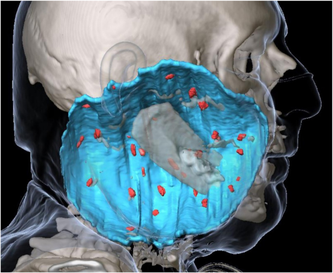 Figure 4
