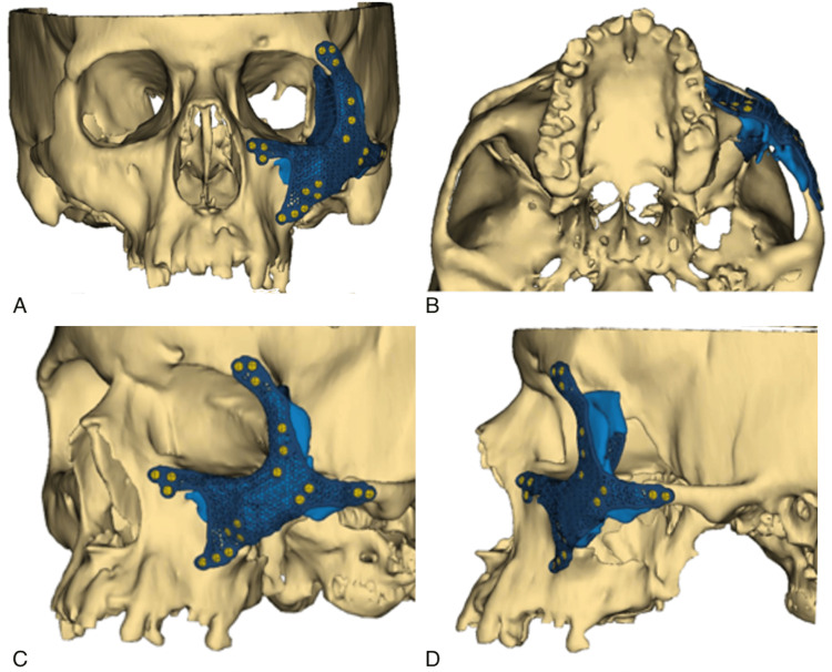 Figure 2
