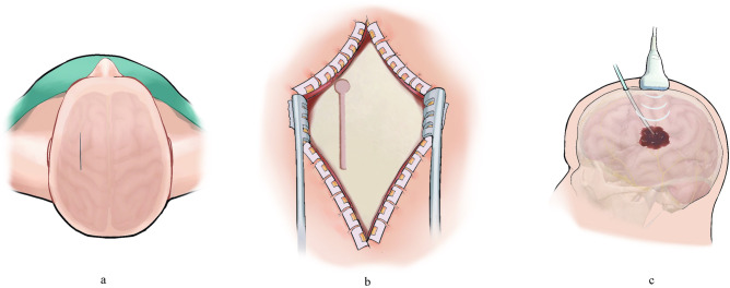 Fig 2