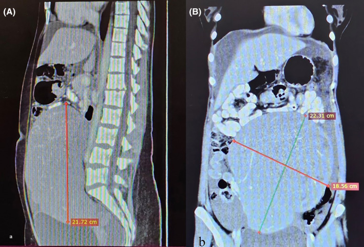 FIGURE 1