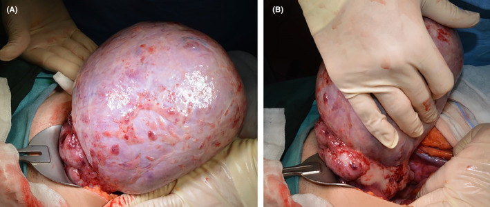 FIGURE 2