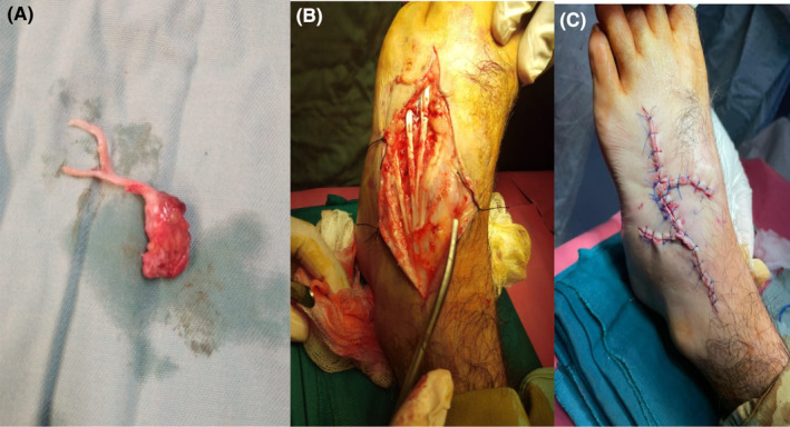 FIGURE 3