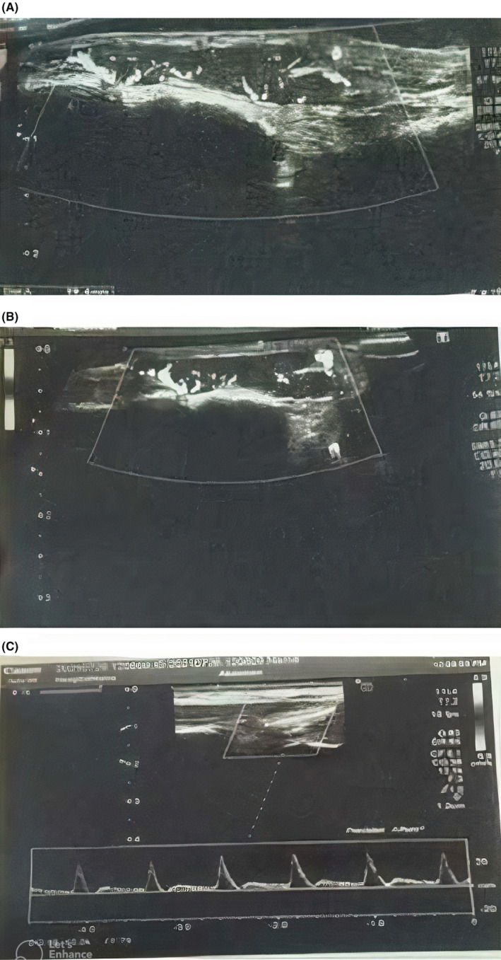 FIGURE 2